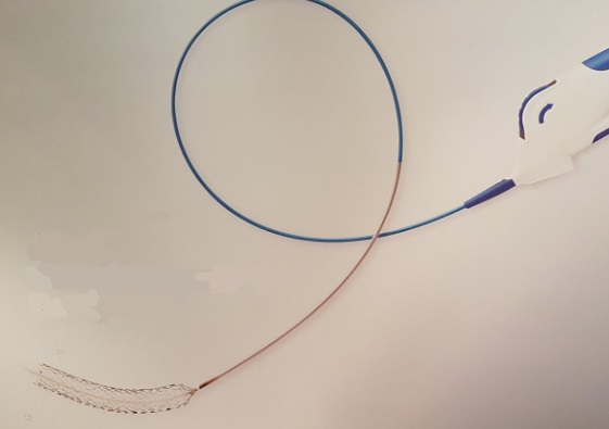 The Abre venous self expanding stent from Medtronic